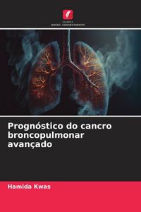 Produktbild: Progn&oacute;stico do cancro broncopulmonar avan&ccedil;ado