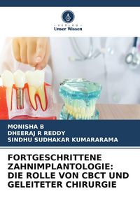 Produktbild: FORTGESCHRITTENE ZAHNIMPLANTOLOGIE: DIE ROLLE VON CBCT UND GELEITETER CHIRURGIE