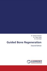 Produktbild: Guided Bone Regeneration