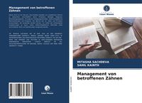 Produktbild: Management von betroffenen Z&auml;hnen