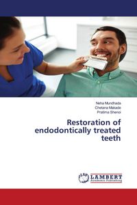 Produktbild: Restoration of endodontically treated teeth