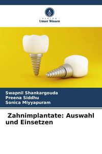 Produktbild: Zahnimplantate: Auswahl und Einsetzen