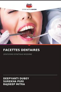 Produktbild: Facettes Dentaires