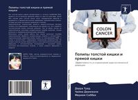 Produktbild: Polipy tolstoj kishki i prqmoj kishki