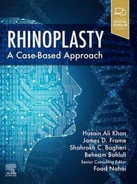 Produktbild: Rhinoplasty E-Book