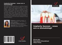Produktbild: Implanty bazowe - nowa era w stomatologii