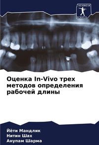 Produktbild: Ocenka In-Vivo treh metodow opredeleniq rabochej dliny
