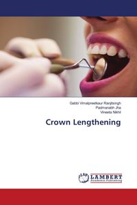 Produktbild: Crown Lengthening
