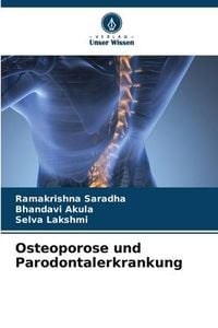 Produktbild: Osteoporose und Parodontalerkrankung