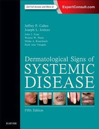 Produktbild: Dermatological Signs of Systemic Disease