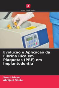 Produktbild: Evolu&ccedil;&atilde;o e Aplica&ccedil;&atilde;o da Fibrina Rica em Plaquetas (PRF) em Implantodontia