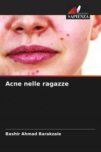 Produktbild: Acne nelle ragazze