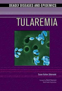 Produktbild: Siderovski, S: Tularemia