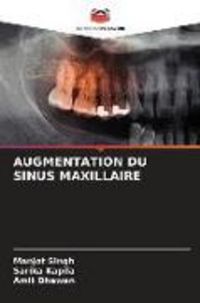 Produktbild: Augmentation Du Sinus Maxillaire