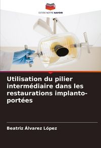 Produktbild: Utilisation du pilier interm&eacute;diaire dans les restaurations implanto-port&eacute;es
