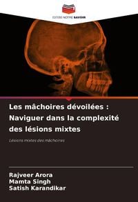 Produktbild: Les m&acirc;choires d&eacute;voil&eacute;es : Naviguer dans la complexit&eacute; des l&eacute;sions mixtes