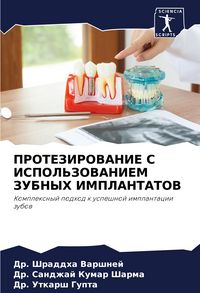 Produktbild: Protezirovanie S Ispol'zovaniem Zubnyh Implantatov