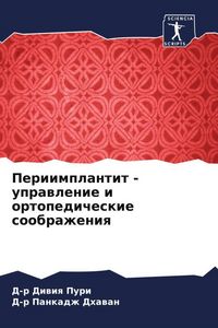 Produktbild: Periimplantit - uprawlenie i ortopedicheskie soobrazheniq