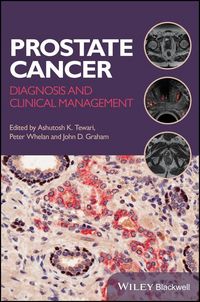 Produktbild: Prostate Cancer