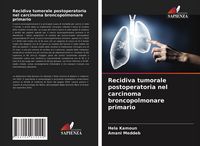 Produktbild: Recidiva tumorale postoperatoria nel carcinoma broncopolmonare primario