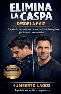 Produktbild: Elimina La Caspa Desde La Ra&iacute;z