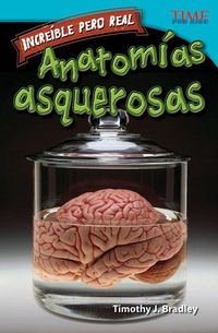 Produktbild: Incre&iacute;ble Pero Real: Anatom&iacute;a Gruesa