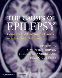 Produktbild: Causes of Epilepsy