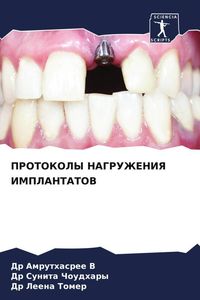 Produktbild: Protokoly Nagruzheniya Implantatov