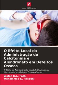 Produktbild: O Efeito Local da Administra&ccedil;&atilde;o de Calcitonina e Alendronato em Defeitos &Oacute;sseos