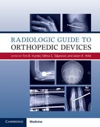 Produktbild: Radiologic Guide to Orthopedic Devices