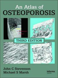Produktbild: Stevenson, J: Atlas of Osteoporosis