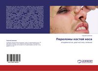 Produktbild: Perelomy kostej nosa