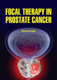 Produktbild: Focal Therapy in Prostate Cancer