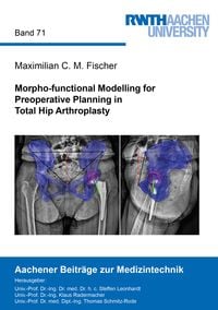 Produktbild: Morpho-functional Modelling for Preoperative Planning in Total Hip Arthroplasty