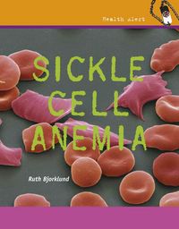 Produktbild: Sickle Cell Anemia