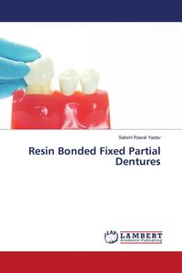 Produktbild: Resin Bonded Fixed Partial Dentures