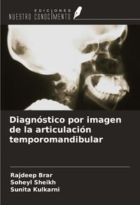Produktbild: Diagn&oacute;stico por imagen de la articulaci&oacute;n temporomandibular