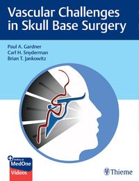 Produktbild: Vascular Challenges in Skull Base Surgery