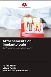 Produktbild: Attachements en implantologie