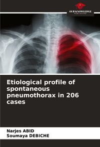 Produktbild: Etiological profile of spontaneous pneumothorax in 206 cases