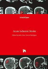 Produktbild: Acute Ischemic Stroke
