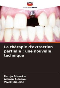 Produktbild: La th&eacute;rapie d'extraction partielle : une nouvelle technique