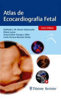 Produktbild: Atlas de Ecocardiografia Fetal