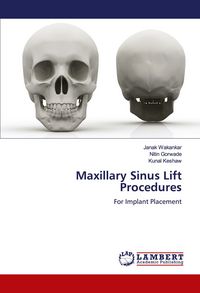 Produktbild: Maxillary Sinus Lift Procedures