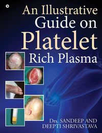 Produktbild: An Illustrative Guide on Platelet Rich Plasma