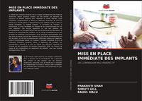 Produktbild: Mise En Place Imm&eacute;diate des Implants