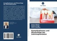 Produktbild: Komplikationen und Misserfolge bei Zahnimplantaten