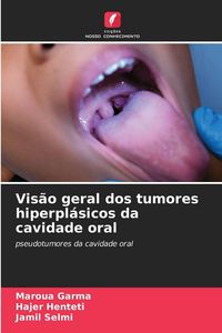 Produktbild: Vis&atilde;o geral dos tumores hiperpl&aacute;sicos da cavidade oral