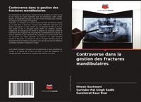 Produktbild: Controverse dans la gestion des fractures mandibulaires