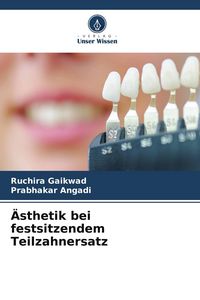 Produktbild: &Auml;sthetik bei festsitzendem Teilzahnersatz